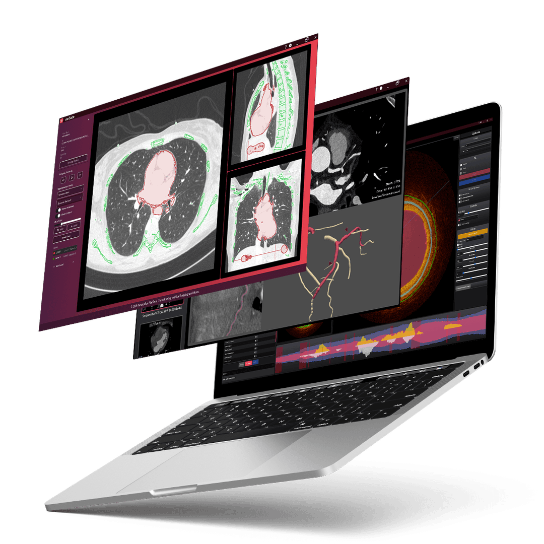 AI-Powered Coronary Analytics